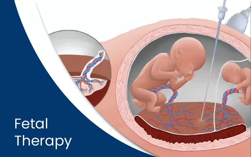 Fetal Therapy and Intrauterine Blood Transfusion